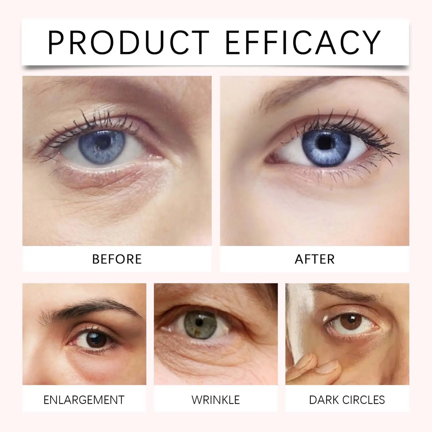 Retinooli silmakreem sügav niisutav Aasia Centella ekstraktiga