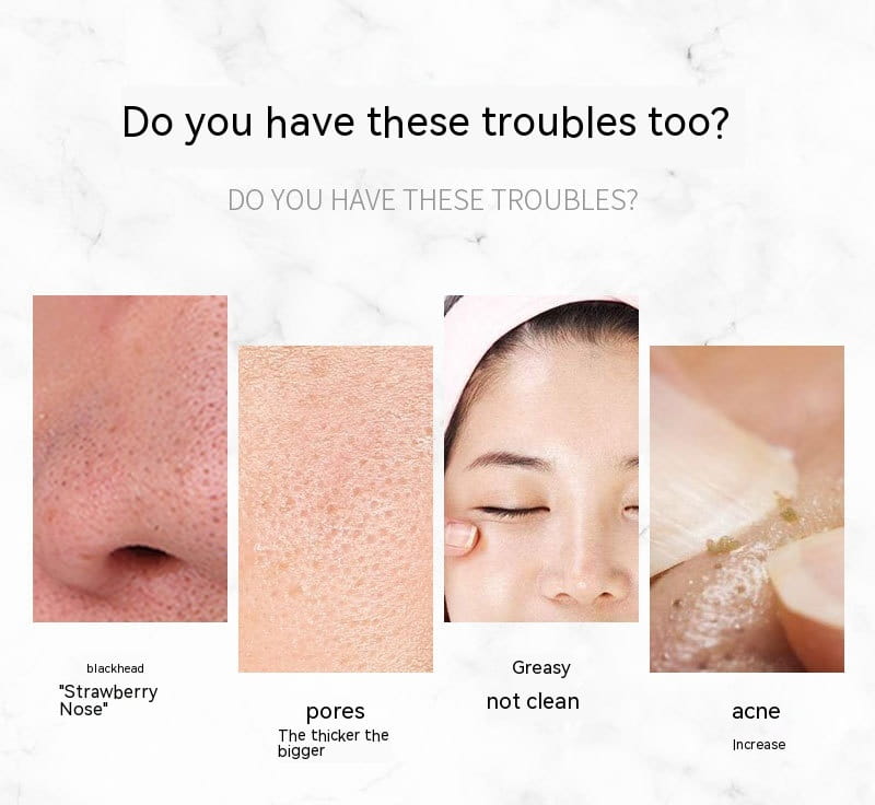 Household Beauty Ultrasonic Skin Cleaner Blackhead Remover