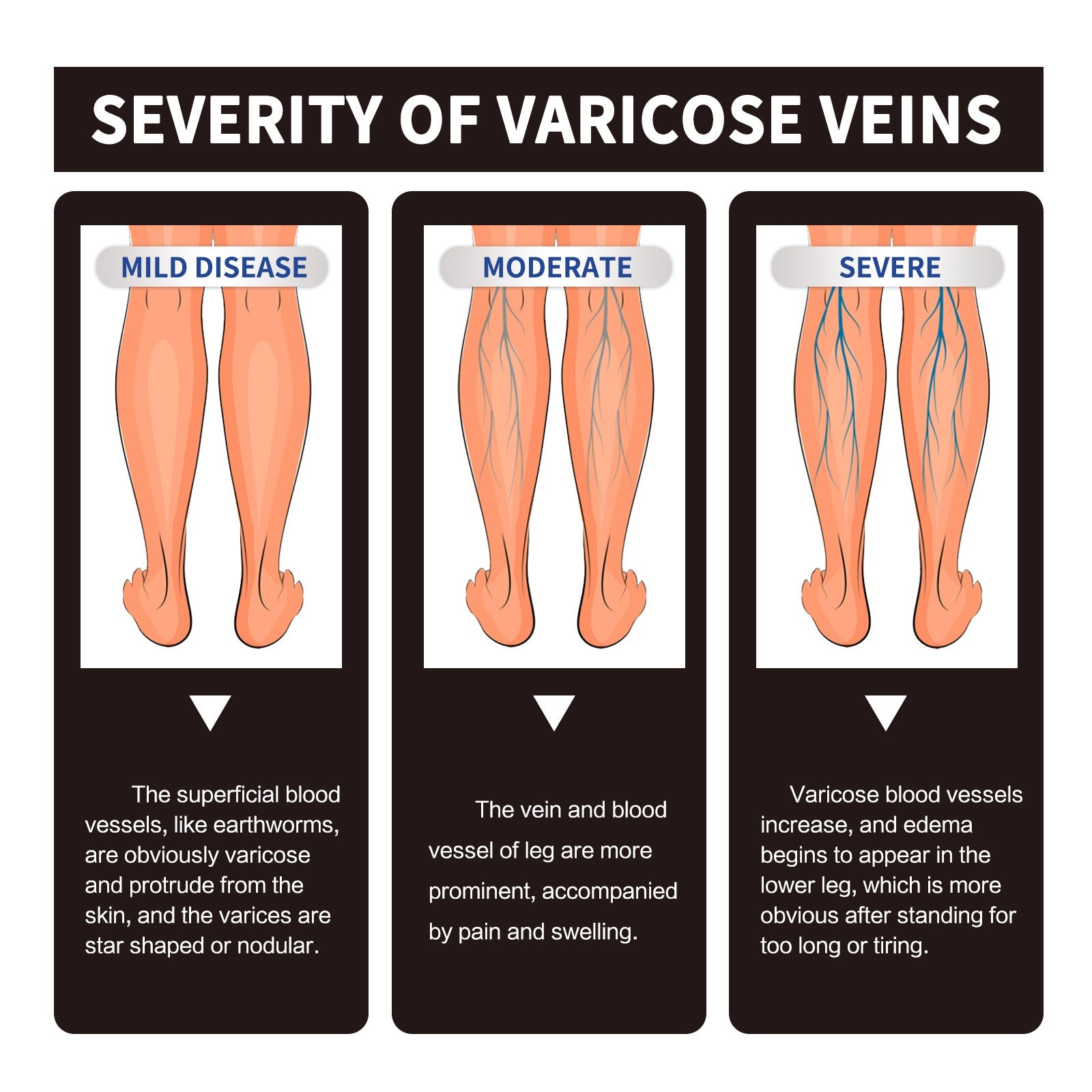 10ml Chamomile Essential Oil Body Care Kit for Relaxation and Skin - Teleplus essential oil