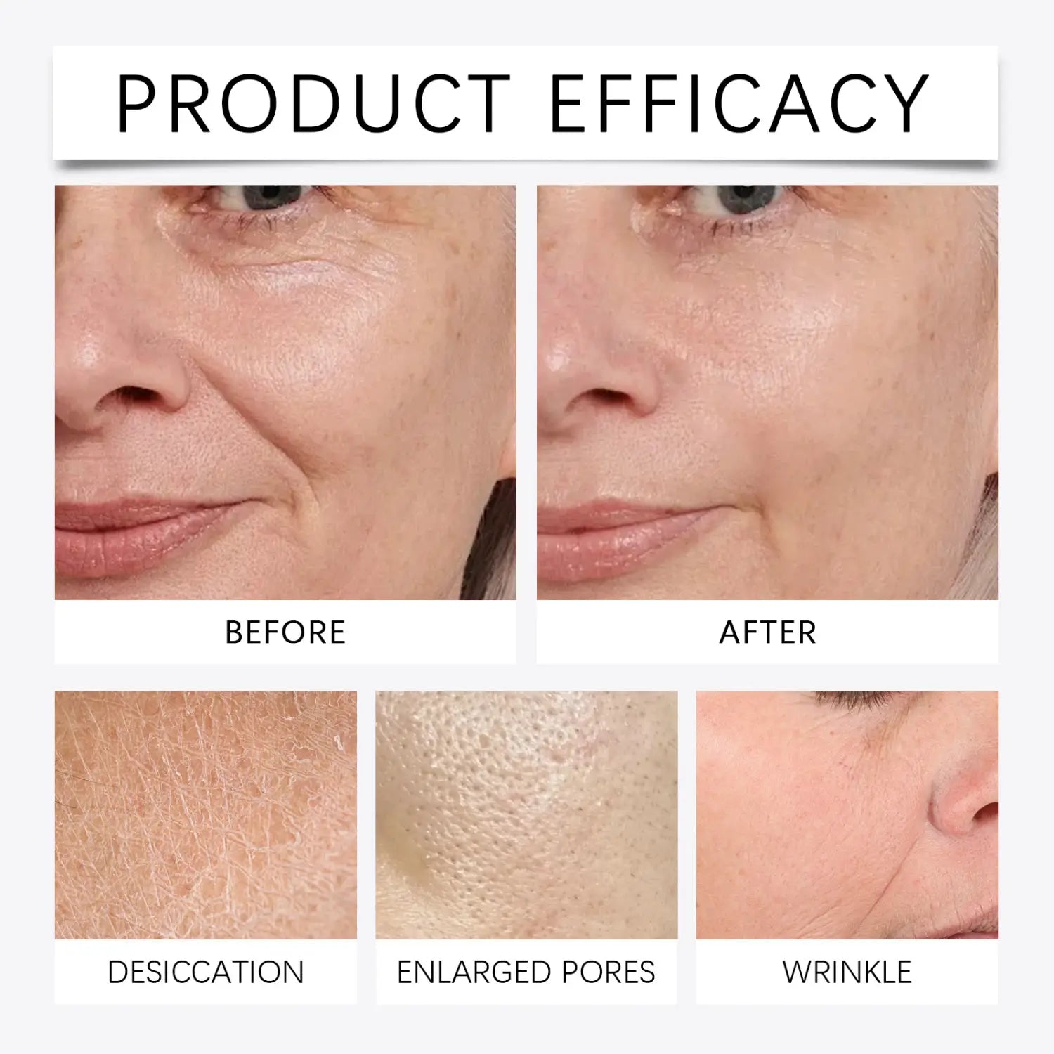 Firming Roller Suit Facial Hydrating Essence with Vitamin E and Tea Tree Oil