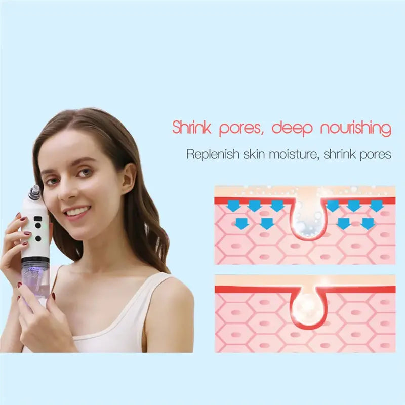 Electric Facial Cleaning Vacuum Cleaner Blackhead Ance Remover Shrink Pores Hydrating Face Skin Care Peeling Device