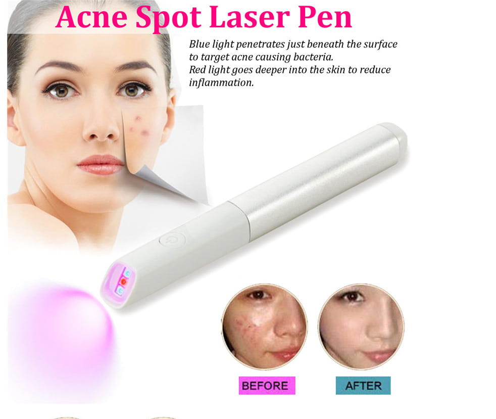 Acne Pen Acne Marks Rehabilitation Instrument Facial Beauty Red Blue Light LED Anti-acne Apparatus