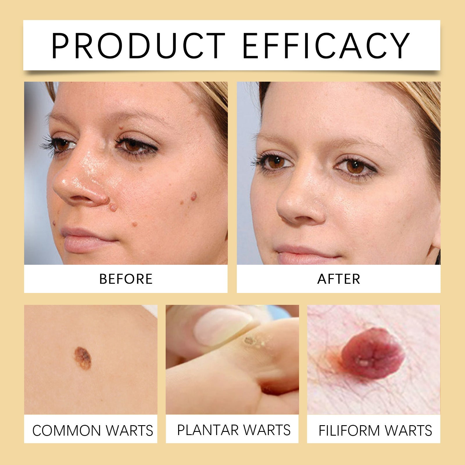 20g Body Care Ointment Pack Healing Skin Moisturizer for Dry Hands - Teleplus healing skin moisturizer body care