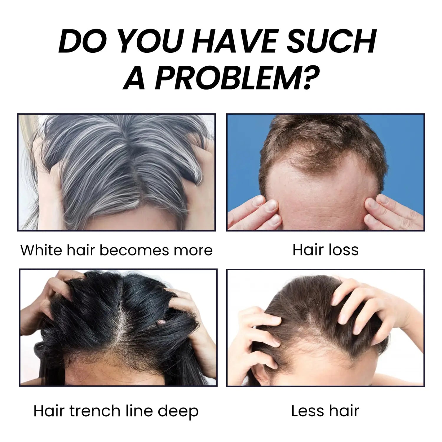 Trèfle rouge et curcumine Huile de soins capillaires pour un traitement nourrissant