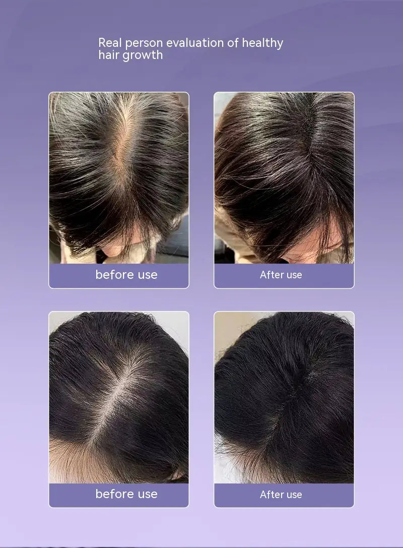 White 9 154 Scalp Medicine Feeder with Red Light Hair Massage Therapy