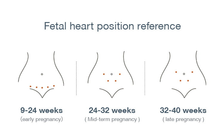 Power Dry Battery for Fetal Heart Monitors in the United States