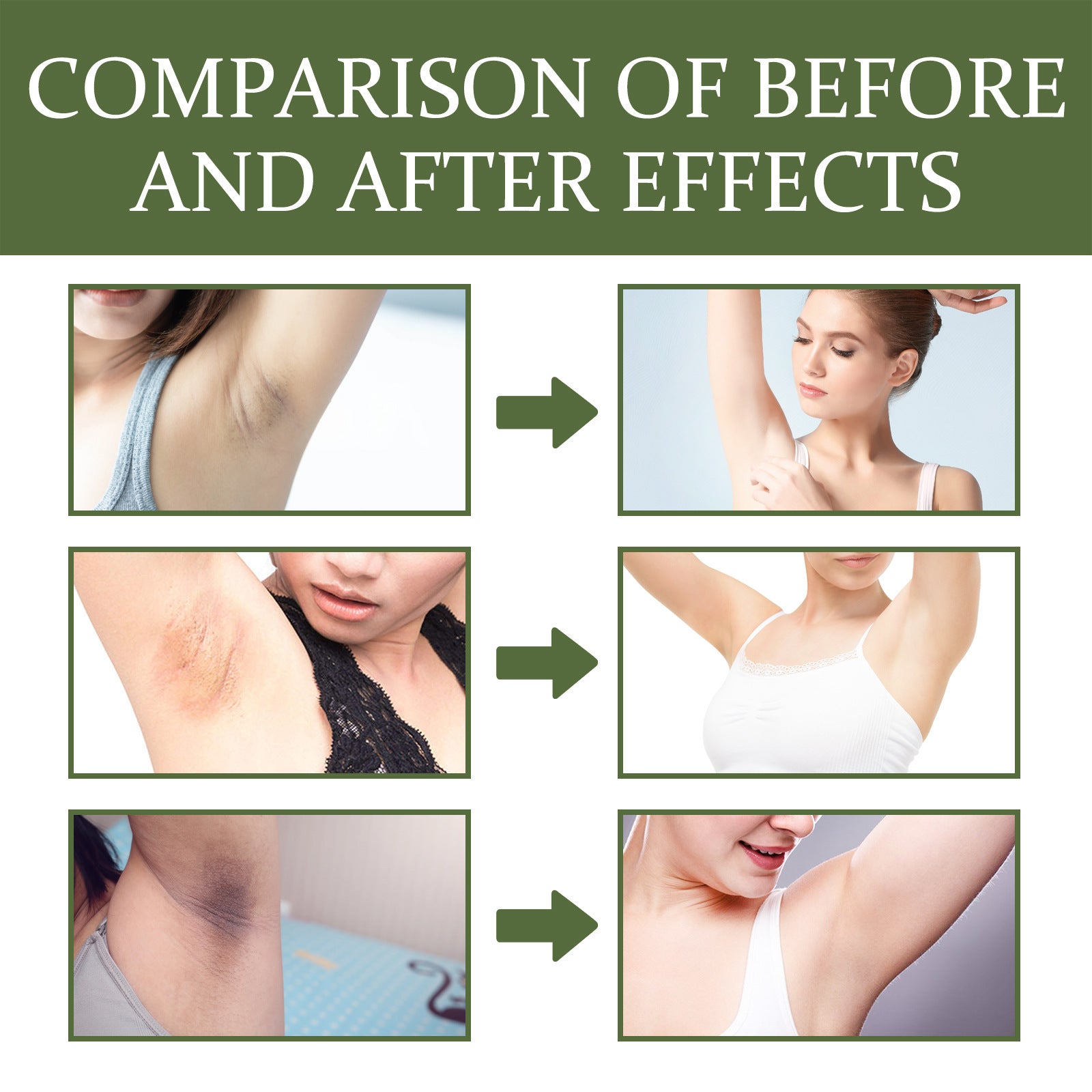 30g Export Only Care Cream for Body and Face Moisturizing Skin - Teleplus care cream