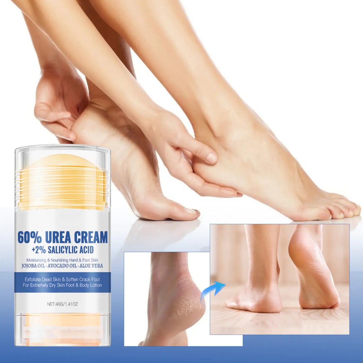 Moisturizing Foot Cream with Aloe Vera Jojoba and Avocado Oil for Dry Skin