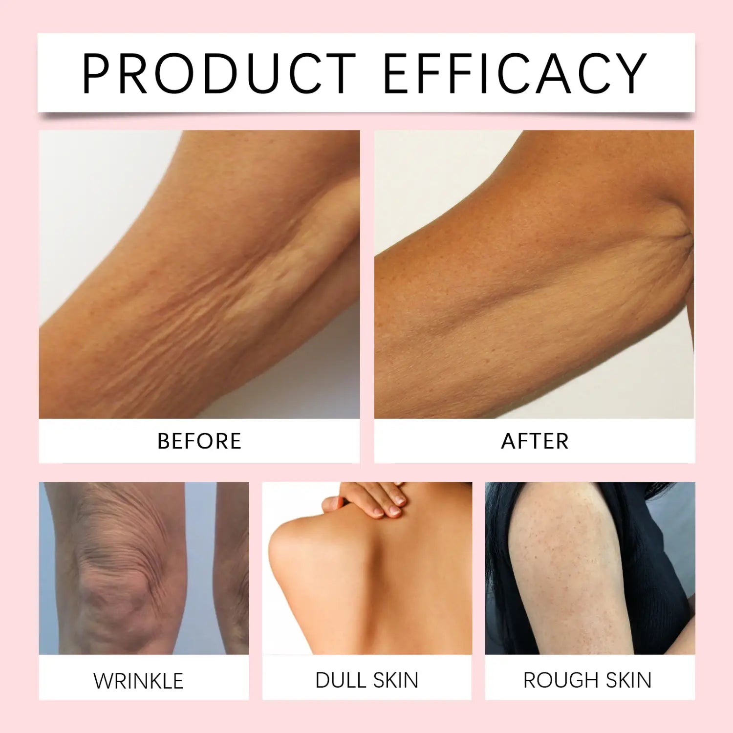 Teleplus Moisturizing Body Lotion for Dry Skin Deep Hydration