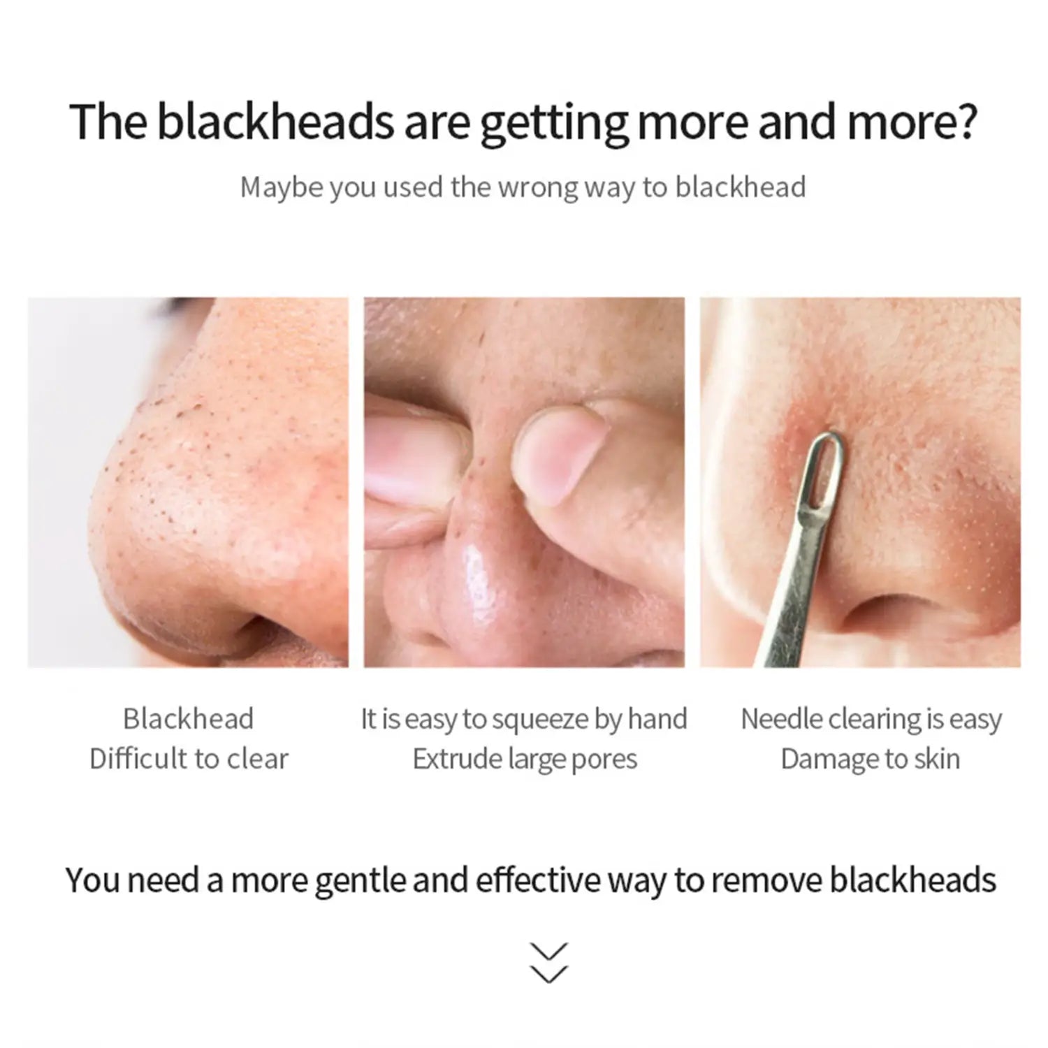 Net 70g Nose Strips for Nursing T District Pack of 1