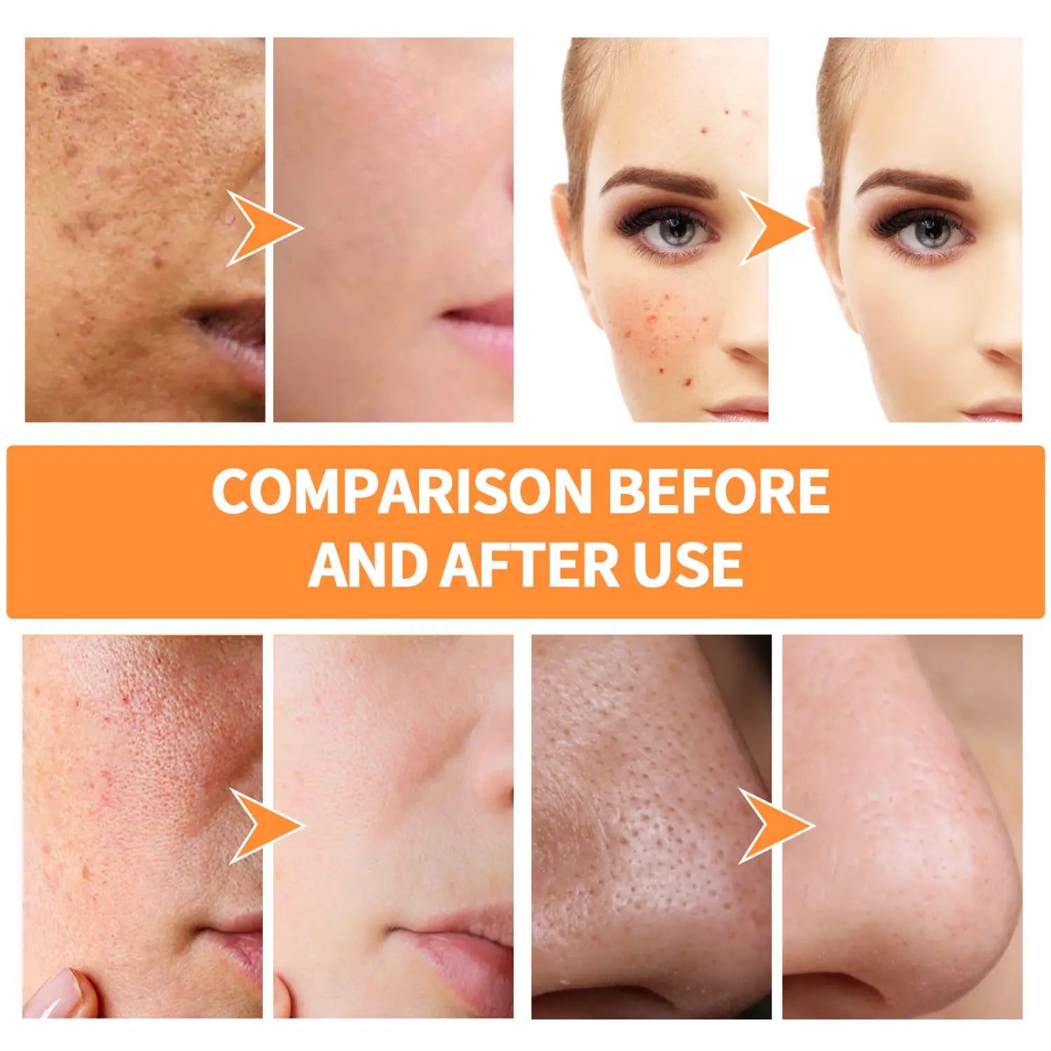 Measc Facial Soladach Craiceann Craiceann Domhain Pore