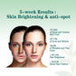 Brightening And Lightening Melasma Blemish Moisturizing And Brightening Skin - Brightening Melasma Blemish Moisturizer