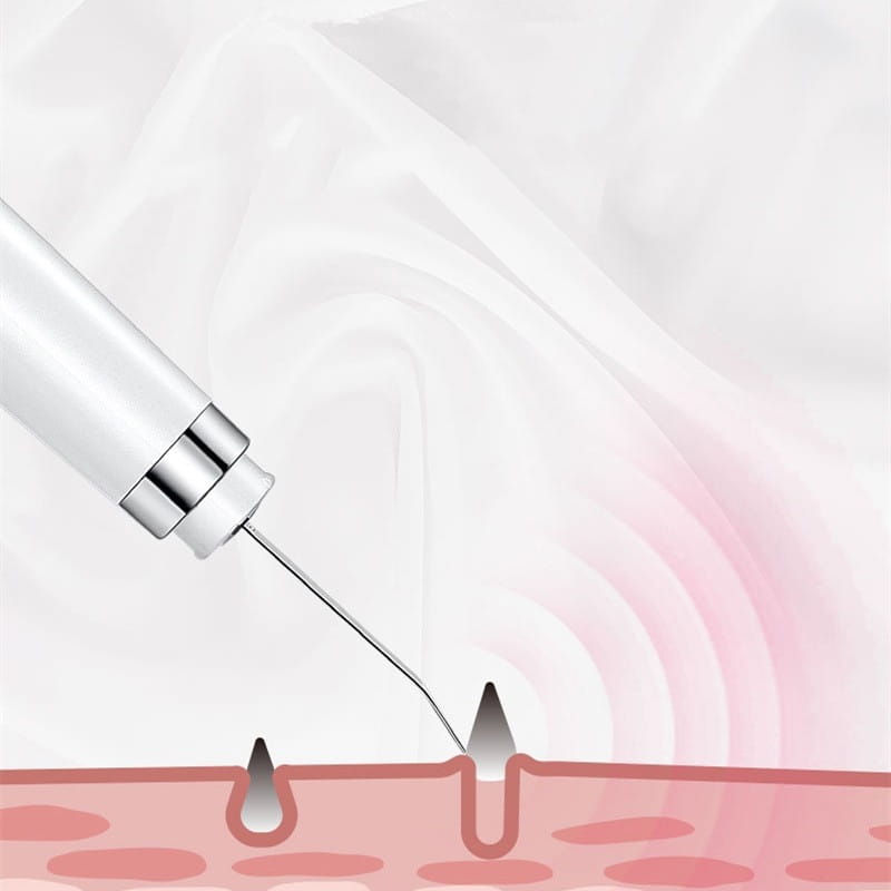 Fabricant de Nettoyeur de Pores à Ultrason