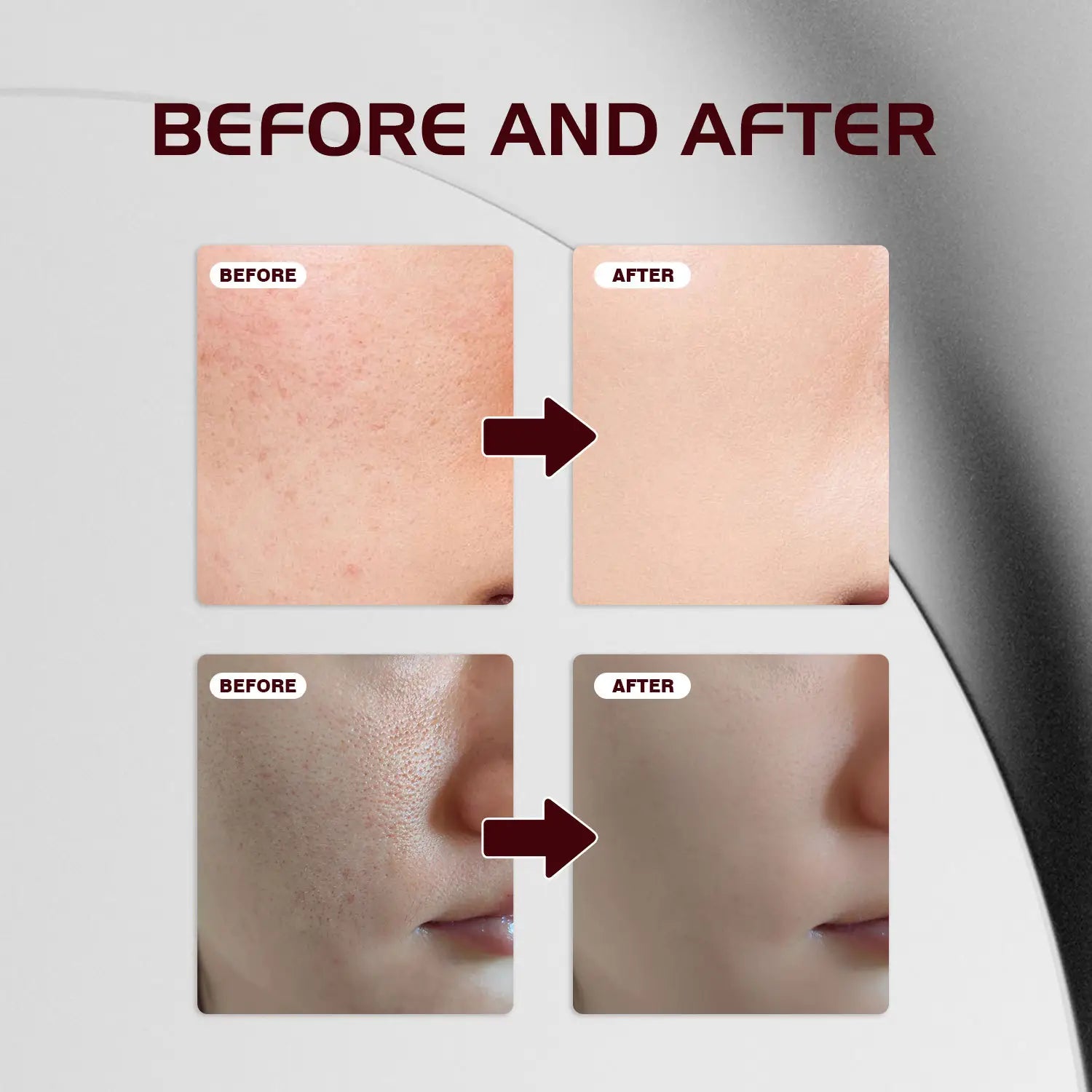 Tartaric Acid Salicylate Facial Essence for Soothing and Clear Skin