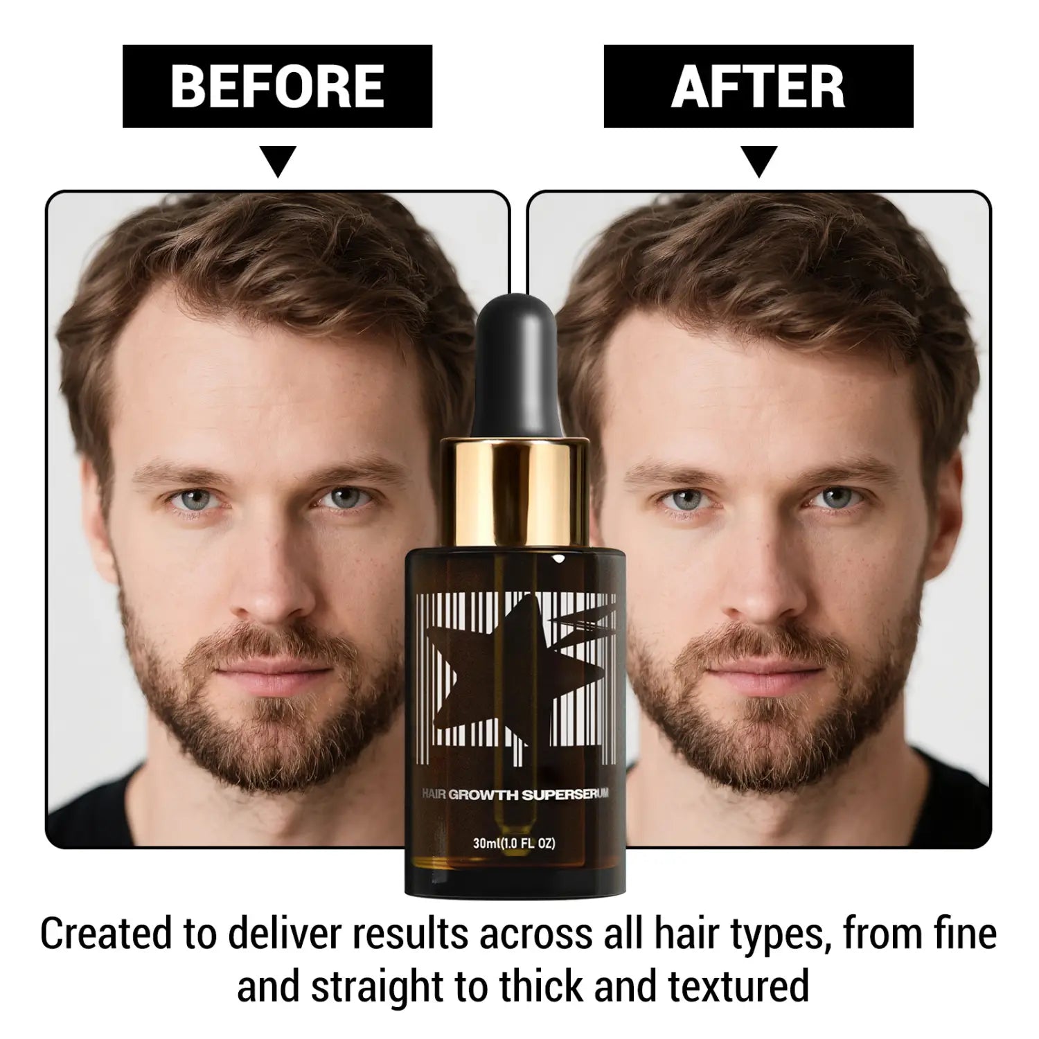 Meeste valgete juuste kasvuõli tiheda 30 ml musta olemuse jaoks