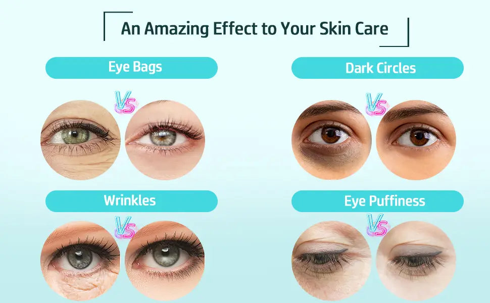 RF Radiofrekvens Øye skjønnhetsinstrument for å fjerne fine linjer kråkeføtter radiofrekvensinstrument øyemassasje