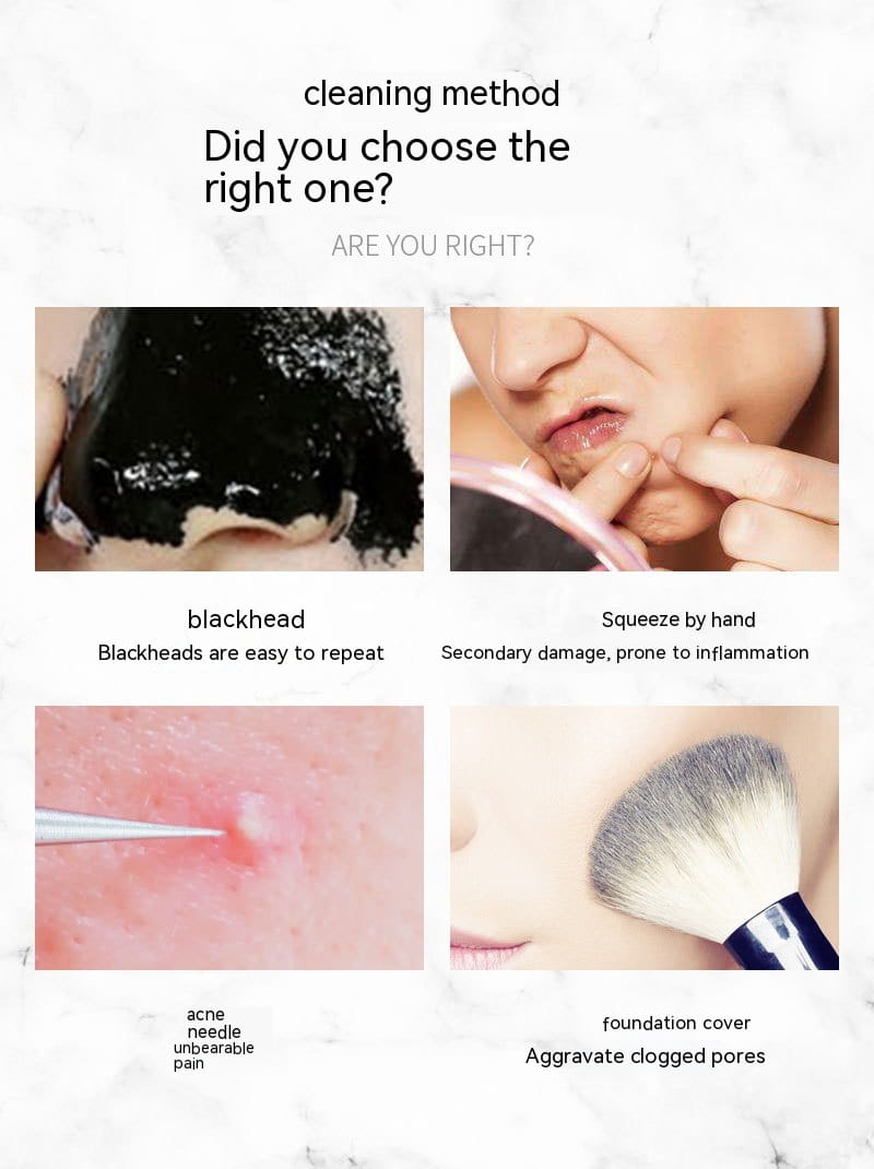 Household Beauty Ultrasonic Skin Cleaner Blackhead Remover