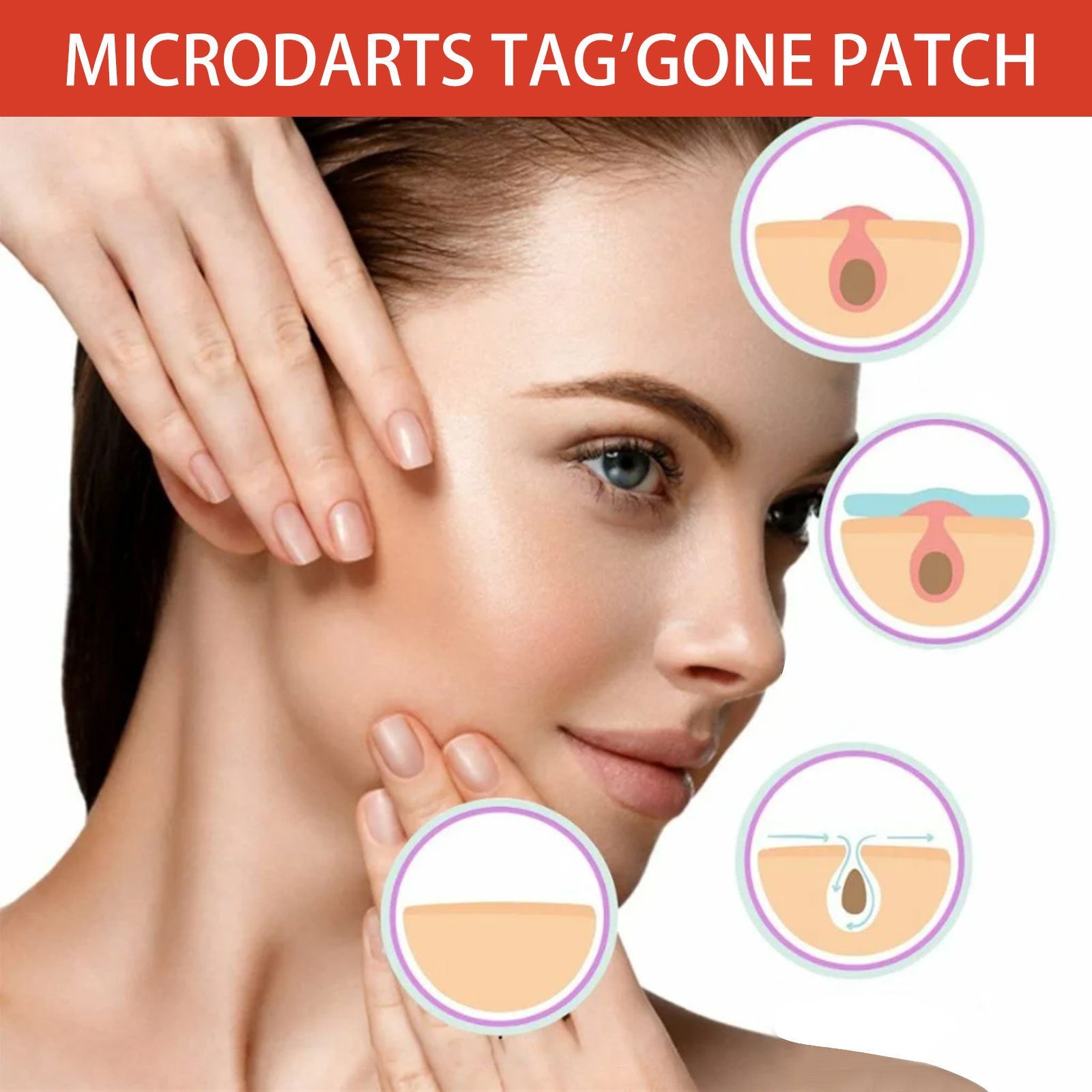Acne Spots Patch with Tea Tree and Calendula for Cleaning Fade - Flawless Skin acne cleaning fade spots patch