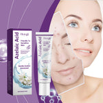 Acne Facial Care Cream for Nourishing Moisturizing Skin and Neck - Teleplus skin nourishing moisturizing neck cream