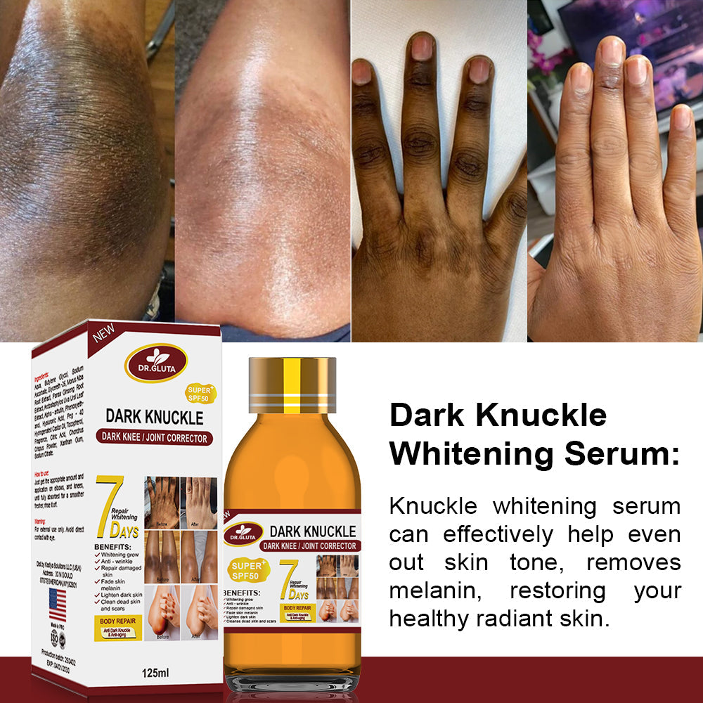 Acne Treatment Kit for Clear Skin Face Serum Cleanser Spot Remover - Teleplus