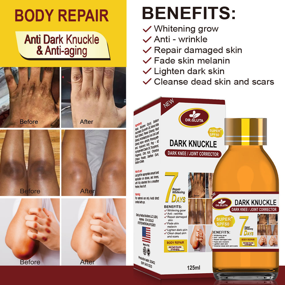 Acne Treatment Kit for Clear Skin Face Serum Cleanser Spot Remover - Teleplus