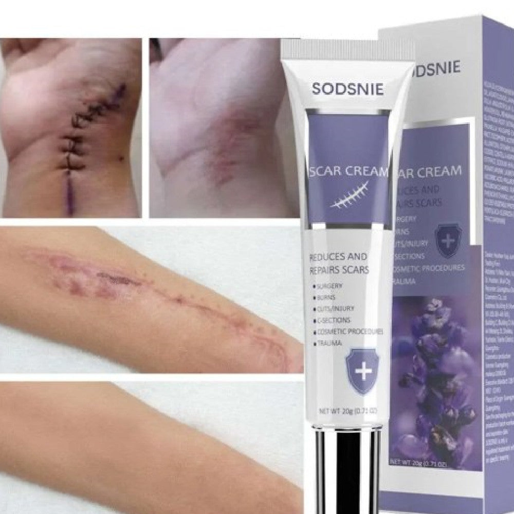 Advanced Scar Cream 20g with Lavender Oil and Natural Extracts - 20G For Your Skin’s Comeback advanced scar cream