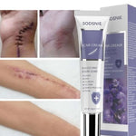 Advanced Scar Cream 20G - Advanced Scar Cream 20G For Your Skin’s Comeback