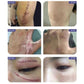 Advanced Scar Cream 20G - Advanced Scar Cream 20G For Your Skin’s Comeback