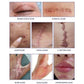 Advanced Scar Cream 20G - Advanced Scar Cream 20G For Your Skin’s Comeback