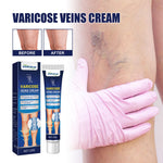 Angelica Sinensis and Ginger Repair Cream for Vein Massage Bulge Relief - Teleplus Zhang zhang cream repair bulge