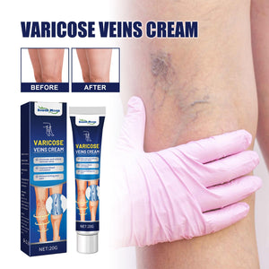 Angelica Sinensis and Ginger Repair Cream for Vein Massage Bulge Relief - Teleplus Zhang zhang cream repair bulge