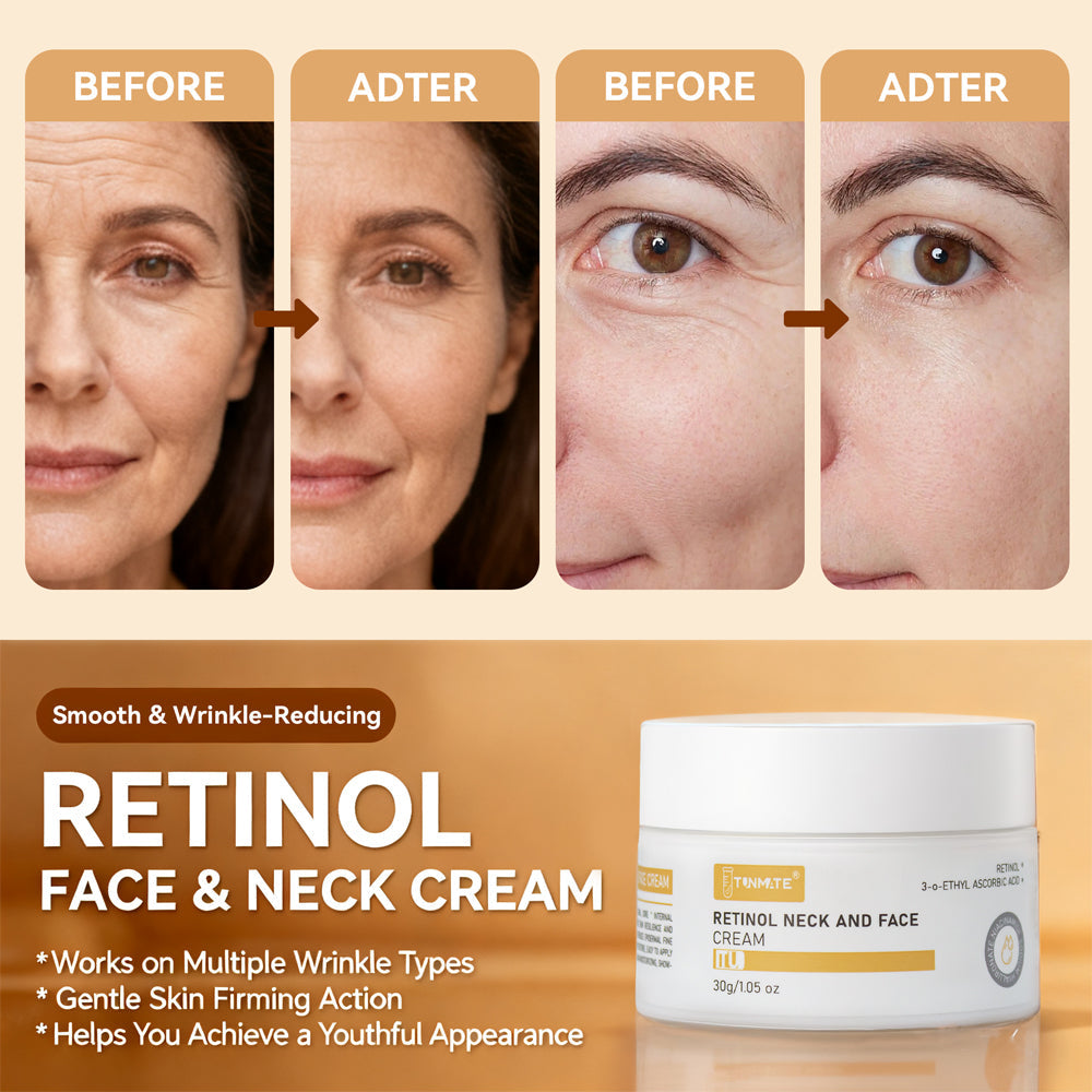 Anti Aging Face Cream Retinol Collagen Hyaluronic Acid Moisturizer for Wrinkles - Teleplus