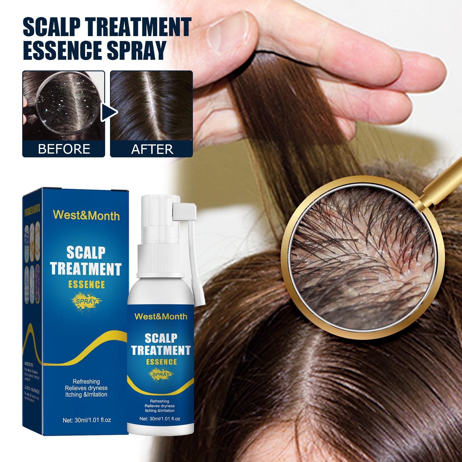 Anti Itch Scalp Treatment Hair Oil Spray 30ml Soothing Head Care for Dry - Teleplus hair oil head care