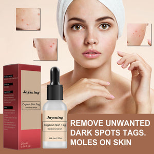 Anti Nevus Potion for Skin Care Remover in 20ml All Types - Teleplus