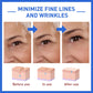 Anti-Wrinkle Firming Head Lifting Pattern French Pattern Fading Wrinkle Botox - Firming Head Lifting French Pattern