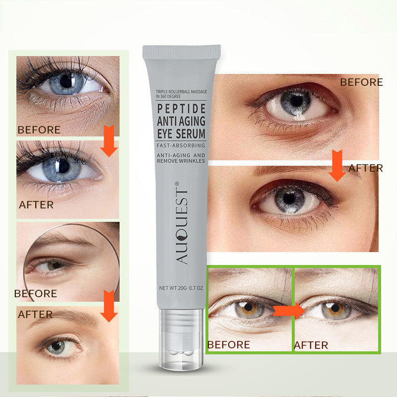 Anti-wrinkle Anti-wrinkle Polypeptide Eye Cream - Wrinkle Be Gone with the Anti-Wrinkle Eye Cream