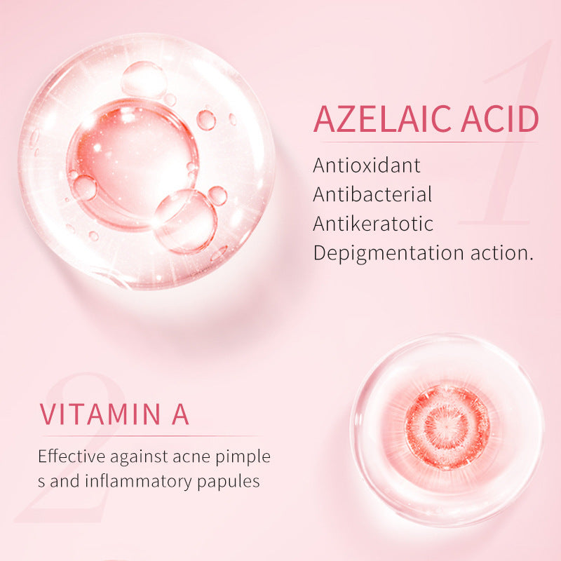 Azelaic Acid Facial Treatment Solution for Moisturizing and Skin Care - azelaic acid facial treatment solution