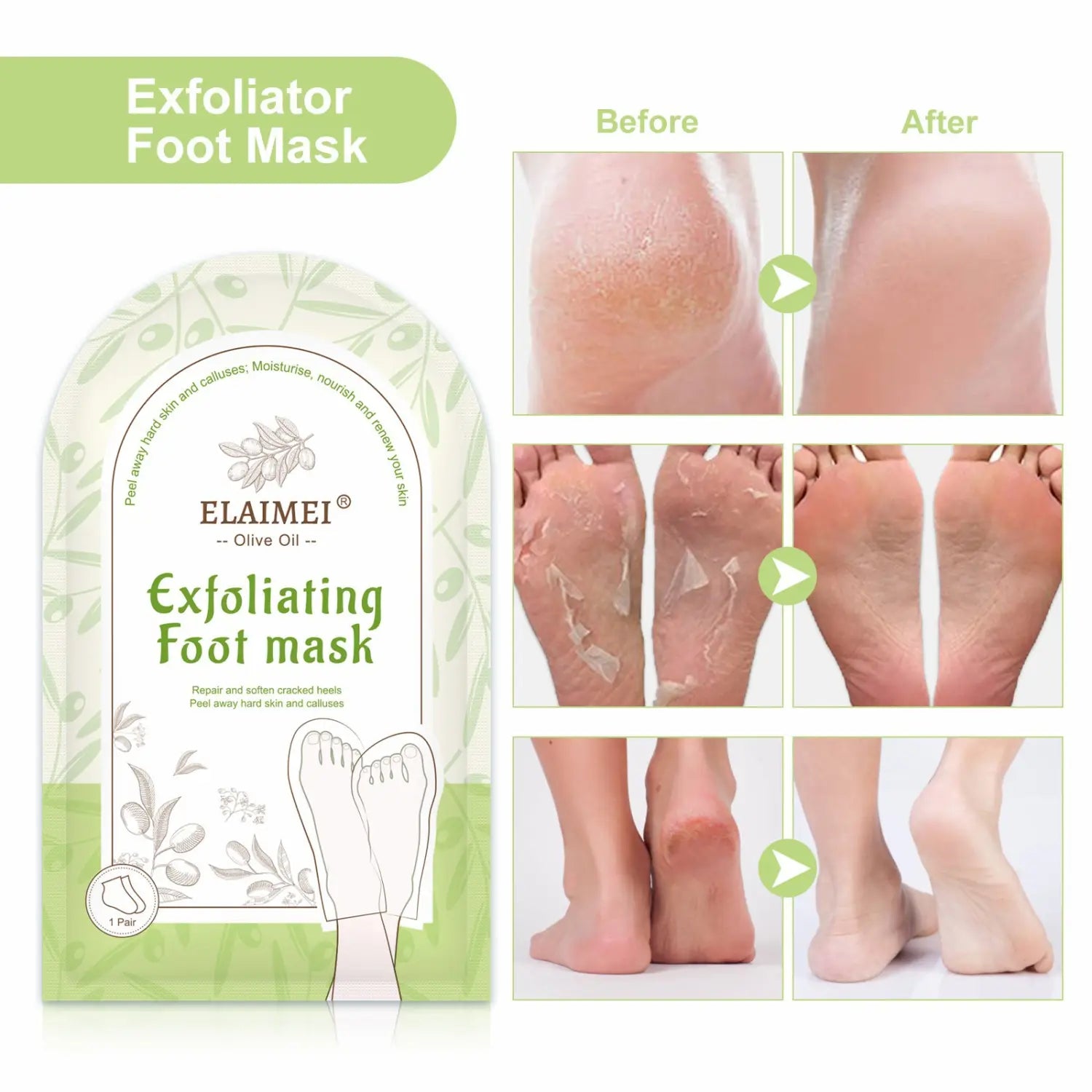 Gentle Exfoliation Of Dead Skin Calluses And Horny Feet