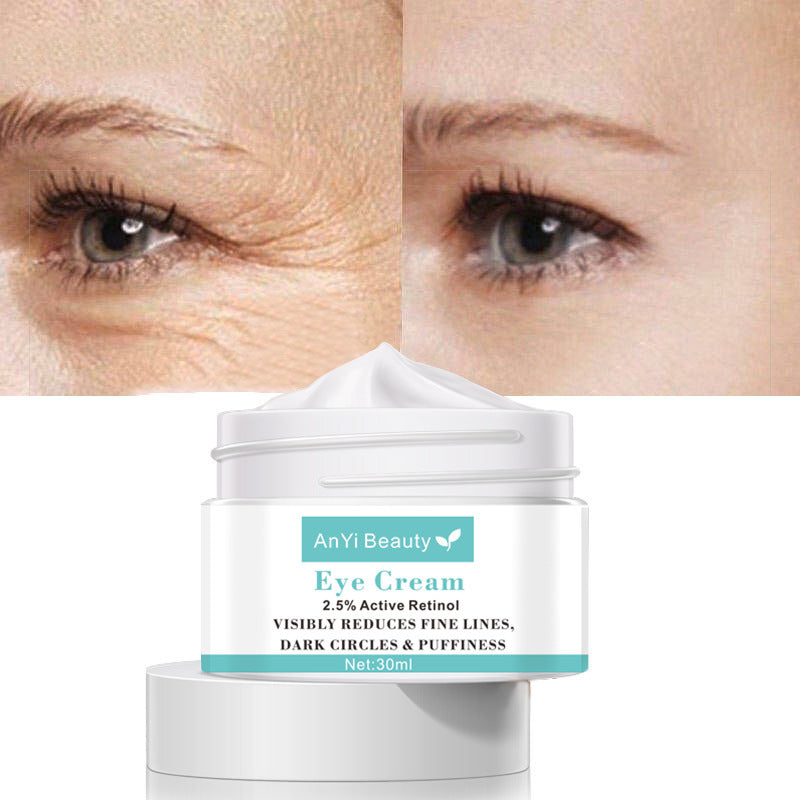 Beauty Eye Cream30mlwish Women’s Skin Care Products - Bye Bye Dark Circles With This Magic Eye Cream