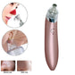 Beauty facial machine - Say Goodbye to Blackheads with Our Funny Face Machine