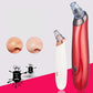 Blackhead instrument pore cleaner to blackhead artifact electric acne machine to blackhead - Bye Bye Blackheads