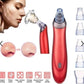 Blackhead instrument pore cleaner to blackhead artifact electric acne machine to blackhead - Bye Bye Blackheads