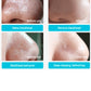 Blackhead nasal membrane with 60 sheets of blackhead tearing powerful to acne T area care - Tear Away Blackheads