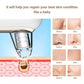 Electric Pore Acne Blackhead Removal Device with 4 Adjustable Gears - Erase Blackheads Our Cleaner blackhead removal