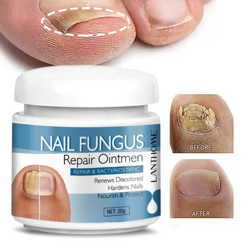 Body Nail Repair Nursing Cream 20g for Care X1pcs - Teleplus body nail repair care nursing cream x1pcs