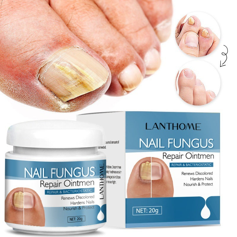 Body Nail Repair Nursing Cream 20g for Care X1pcs - Teleplus body nail repair care nursing cream x1pcs