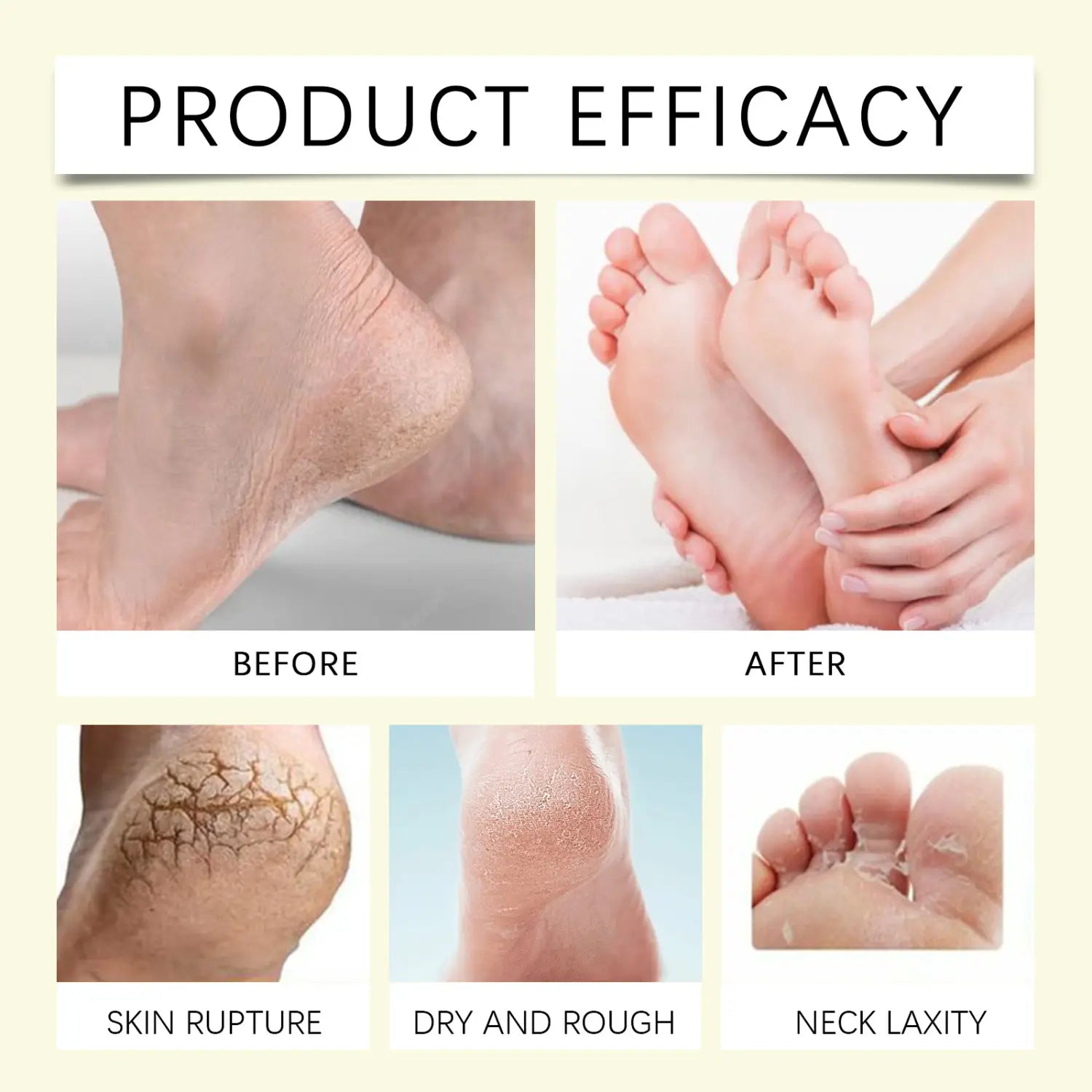 Moisturizing Heel Care Foot Oil and Mask for Softening Cutin Anti-Drying