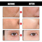 Cleanse Facial Skin With Deep Anti-wrinkle - Wrinkles Beware Cleanse Facial Skin Like Never Before