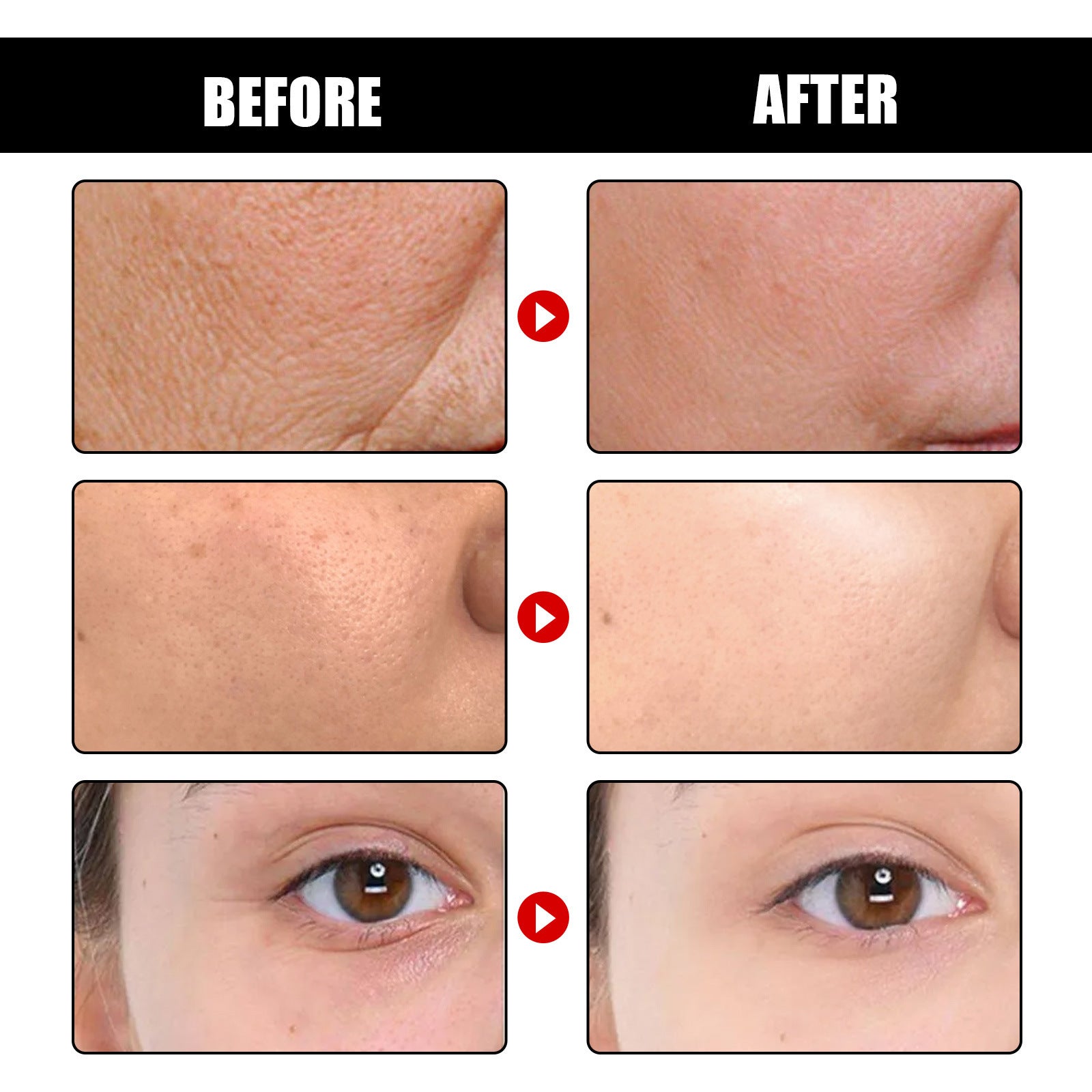 Cleanse Facial Skin With Deep Anti-wrinkle - Wrinkles Beware Cleanse Facial Skin Like Never Before