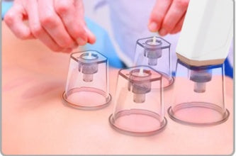 Intelligent Blackhead Absorber Hot Compress for Cleaning and Beauty - Cold Comedic hot compress blackhead cleaning